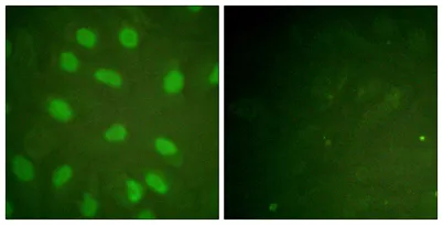 Ku-80 (phospho Thr714) rabbit pAb - image 1