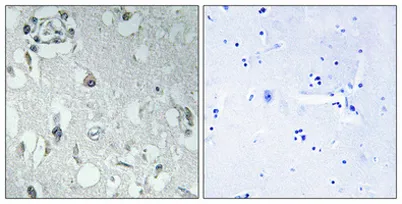 14-3-3 η rabbit pAb - image 1