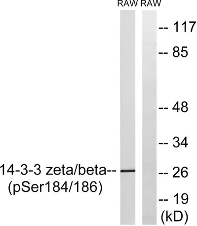 14-3-3 β/ζ (phospho Ser184/186) rabbit pAb - image 1