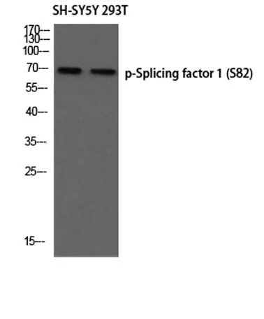 Splicing factor 1 (phospho Ser82) rabbit pAb - image 1