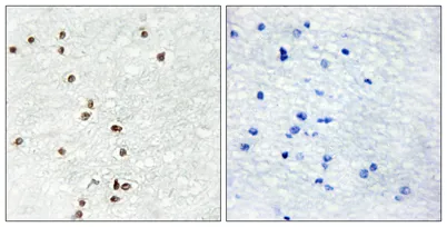 Zic1/2/3 rabbit pAb - image 1
