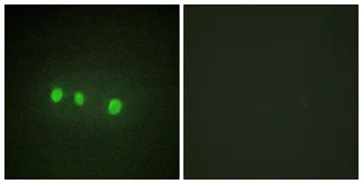 Zic1/2/3/4/5 rabbit pAb - image 1