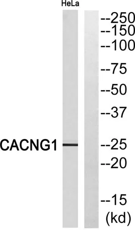L-type Ca++ CP γ1 rabbit pAb - image 1