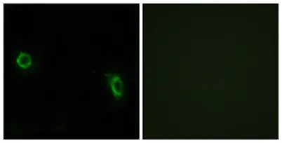 Olfactory receptor 6J1 rabbit pAb