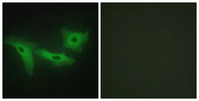 LRRK1 rabbit pAb - image 1