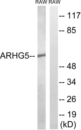 Oncogene TIM rabbit pAb - image 1