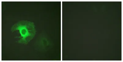 Caldesmon rabbit pAb