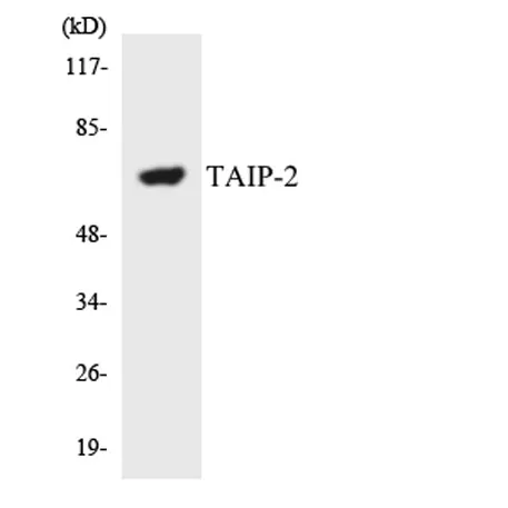 CSRNP3 rabbit pAb