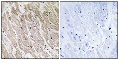 ACAD-10 rabbit pAb - image 1
