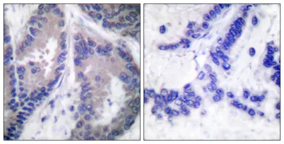 COL18A1 rabbit pAb - image 1