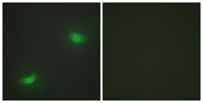 MKP-7 rabbit pAb - image 1