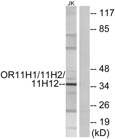 Olfactory receptor 11H1/11H2/11H12 rabbit pAb