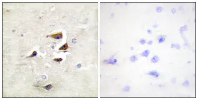 CaMKIIα/β/δ rabbit pAb - image 1