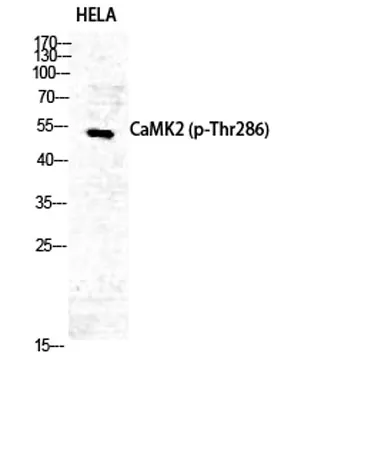 CaMKIIα/δ (phospho Thr286) rabbit pAb - image 1