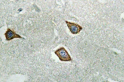 Calpain 2 rabbit pAb - image 1