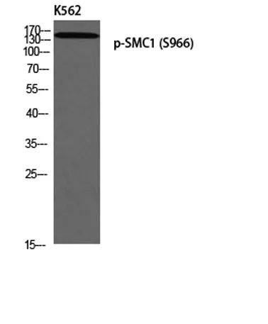 SMC1 (phospho Ser966) rabbit pAb - image 1