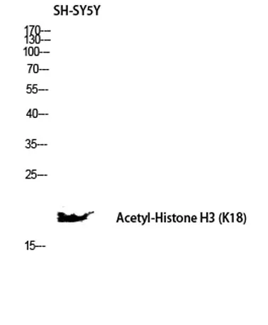 Histone H3 (Acetyl Lys18) rabbit pAb - image 1