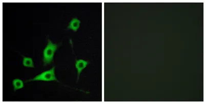 CRBP-III rabbit pAb