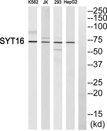 Synaptotagmin XVI rabbit pAb - image 1