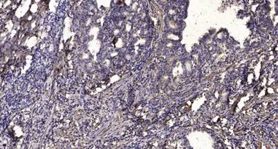 Neurocalcin δ rabbit pAb - image 1