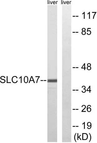 SLC10A7 rabbit pAb - image 1