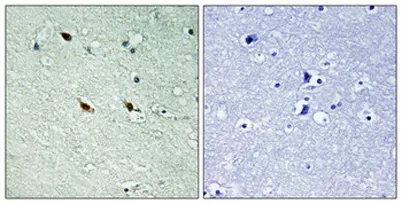 NIFK (phospho Thr234) rabbit pAb