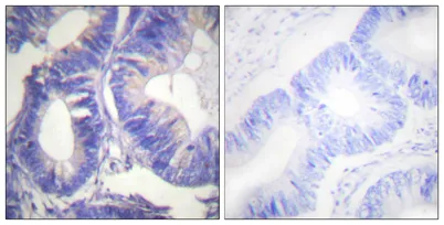 Nck-2 rabbit pAb - image 1