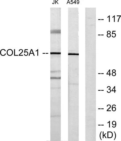 COL25A1 rabbit pAb - image 1