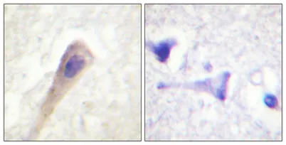 Catalase (phospho Tyr386) rabbit pAb