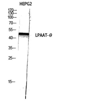 LPAAT-θ rabbit pAb - image 1
