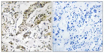 TCEAL3/5/6 rabbit pAb