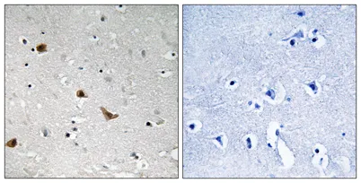 IKKγ (phospho Ser376) rabbit pAb