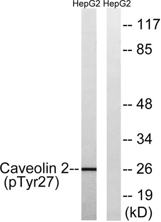 Caveolin-2 (phospho Tyr27) rabbit pAb - image 1