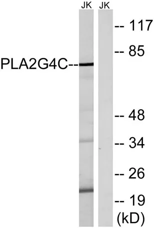 cPLA2-γ rabbit pAb - image 1