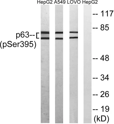 p63 (phospho Ser395) rabbit pAb