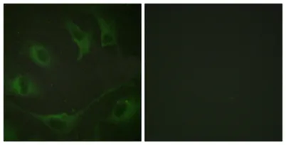 Cbl (phospho Tyr774) rabbit pAb - image 1