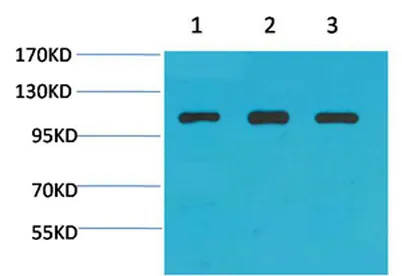 Actinin-α1 rabbit pAb - image 1