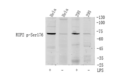 RIP2 (phospho Ser176) rabbit pAb - image 1