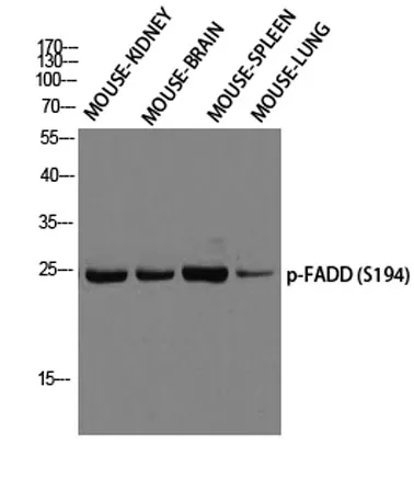 FADD (phospho Ser194) rabbit pAb - image 1