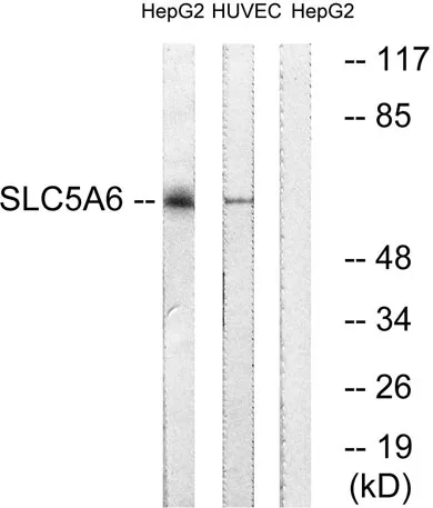 SMVT rabbit pAb - image 1