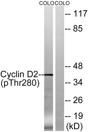 Cyclin D2 (phospho Thr280) rabbit pAb - image 1