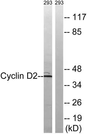 Cyclin D2 rabbit pAb - image 1