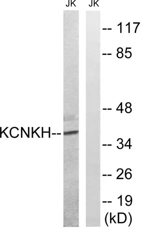 TALK-2 rabbit pAb - image 1