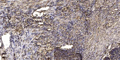 Dok-2 (phospho Tyr345) rabbit pAb - image 1