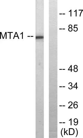 MTA1 rabbit pAb - image 1