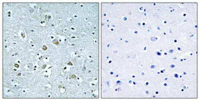 Neuralized-1 rabbit pAb