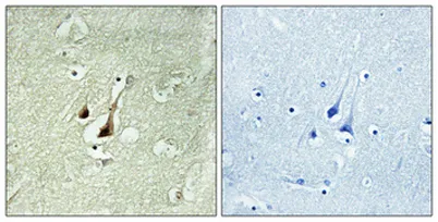 Dyrk1B rabbit pAb - image 1