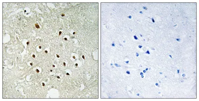 Ribosomal Protein S19BP rabbit pAb