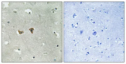 Lfc (phospho Ser886) rabbit pAb