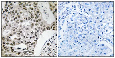 ZNF262 rabbit pAb - image 1